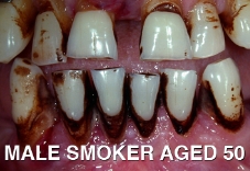 Dental - Male info standard