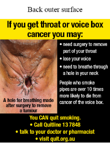 Back outer surface image shows a photo of a throat with a large hole and black stitches around the hole. At the bottom of the image there is a label stating a hole for breathing made after surgery to remove a tumour

Text reads If you get throat or voice box cancer you may: need surgery to remove part of your throat; lose your voice; need to breathe through a hole in your neck.  People who smoke pipes are over 10 times more likely to die from cancer of the voice box. You CAN quit smoking. Call Quitline 13 7848; talk to your doctor or pharmacist; visit quit.org.au

