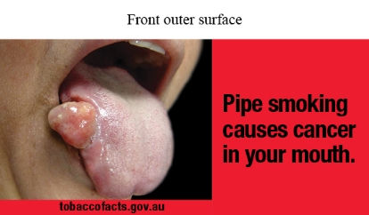 Front outer surface image shows a close up photo of a tongue sticking out of an open mouth with a tumour growth on the side of the tongue.

Text reads Pipe smoking causes cancer in your mouth.
tobaccofacts.gov.au
